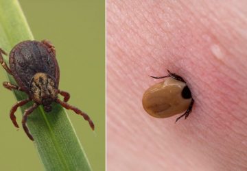 tique insecte maladie été france santé piqure