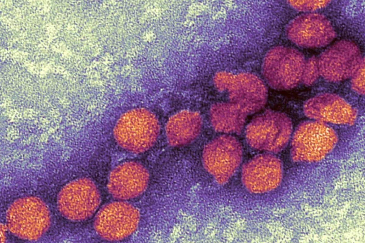 virus france nil moustique (2)