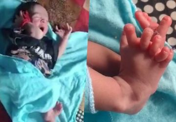 bébé 26 doigts et orteils réincarnation déesse