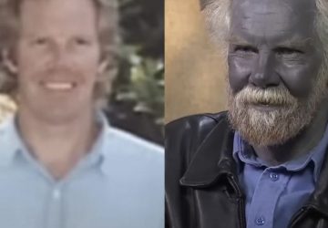 homme bleu schtroumpf santé insolite