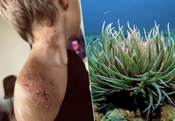 piquee anemone mer vit enfer