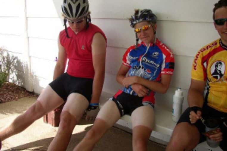 top pires coups de soleil insolites photos (8)