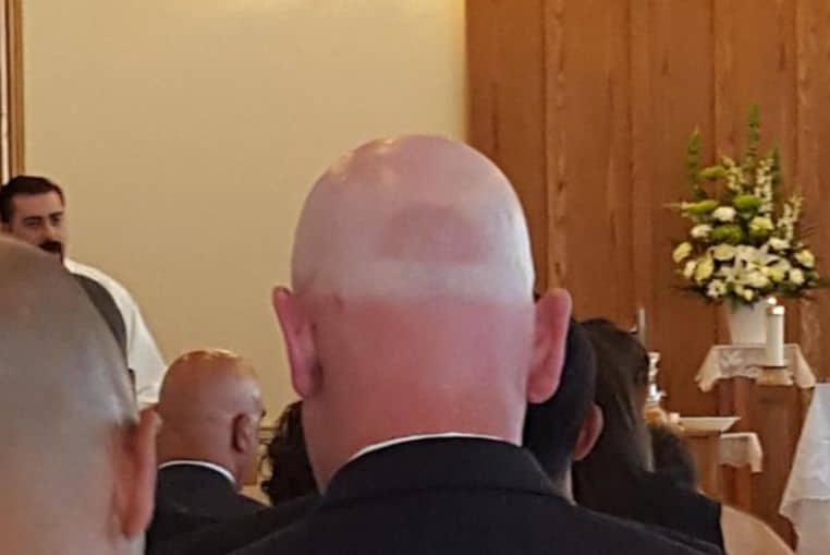 top pires coups de soleil insolites photos (8)