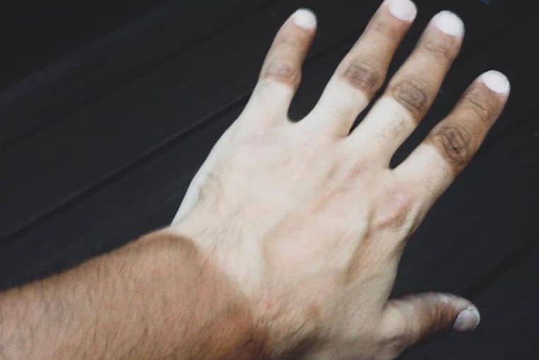 top pires coups de soleil insolites photos (8)