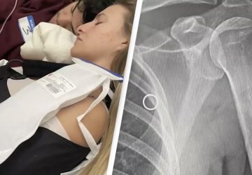 femme enceinte touchée par une balle pendant son sommeil