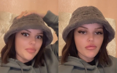 migraine accent