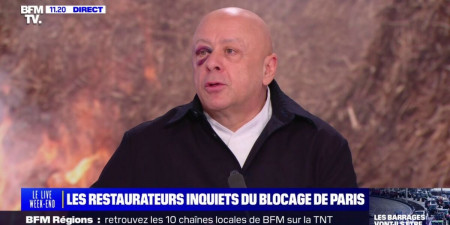 Thierry Marx affublé d'un énorme coquard