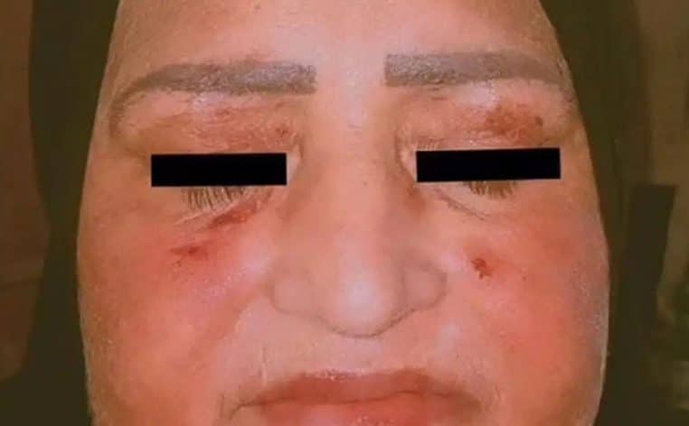 médicaments médicament