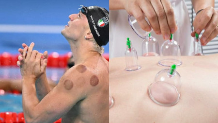 JO Paris 2024 : Voici pourquoi certains champions ont des taches rouges sur le corps