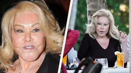 Chirurgie Jocelyne wildenstein histoire