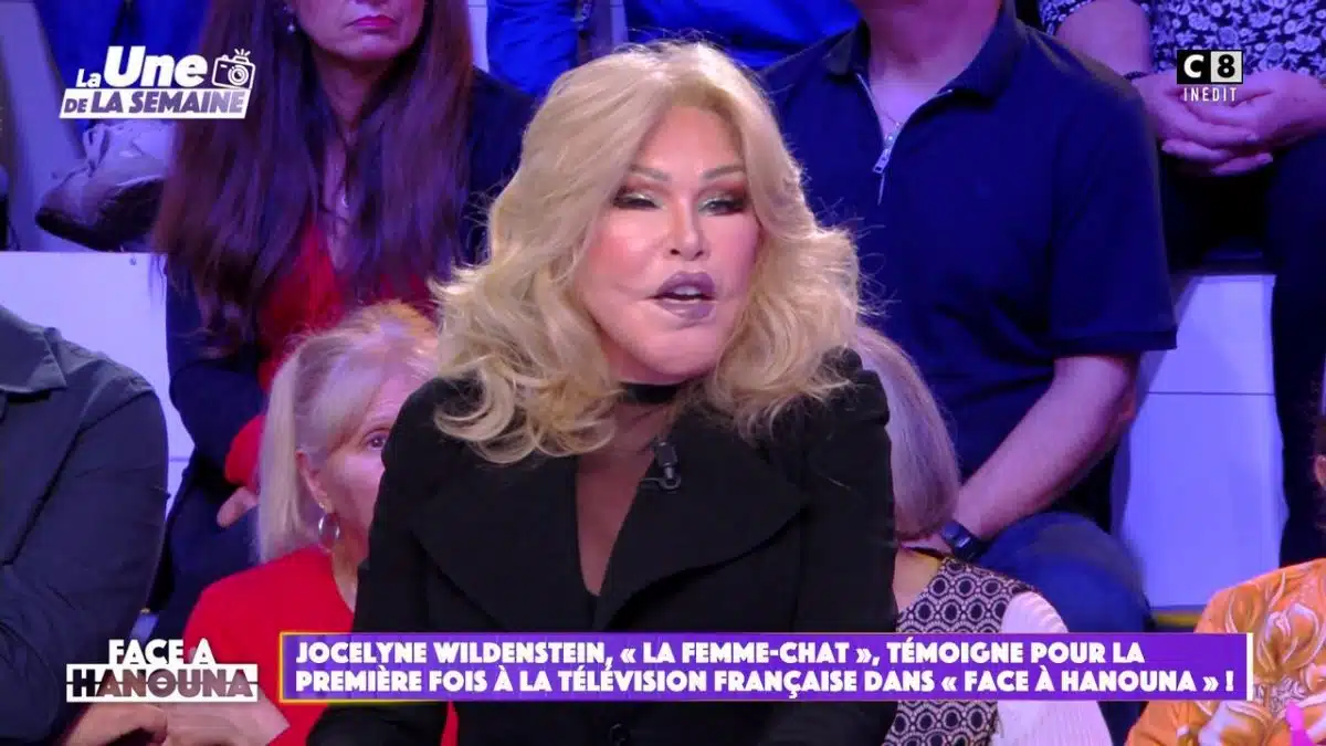 ses-nombreuses-chirurgies-les-rat-s-les-confidences-de-jocelyne