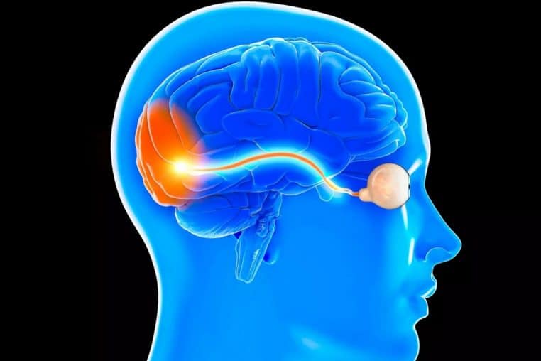 Garcon apathie nerf optique