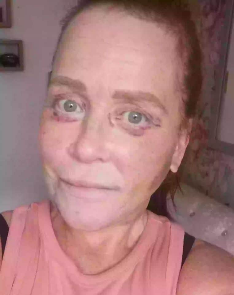 Femme chirurgie ratee