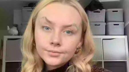Femme maladie yeux