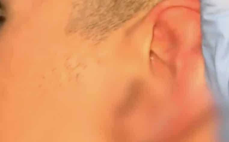 oreilles tendance TikTok