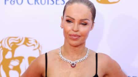 Katie Piper Agression