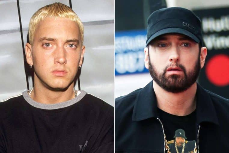 Le rappeur Eminem avant/après.