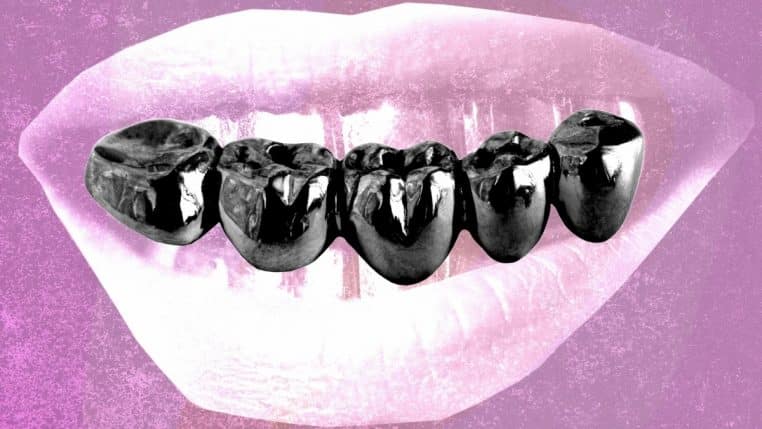 Teeth Blackening Technique