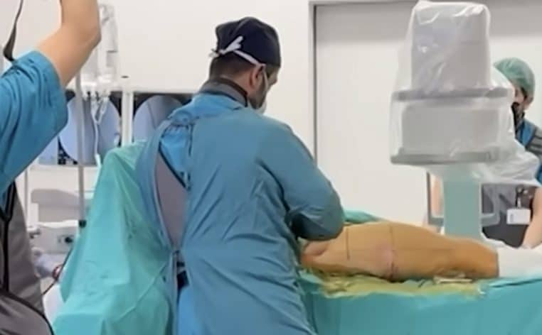 opération chirurgie info