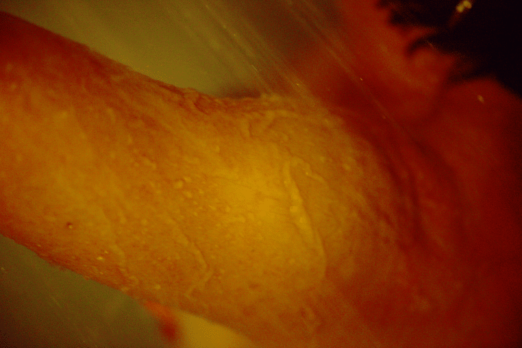 Épaule d’une femme sous un jet d’eau.