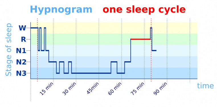 Graphique montrant un hypnogramme d’un cycle de sommeil avec les phases W, R, N1, N2 et N3.