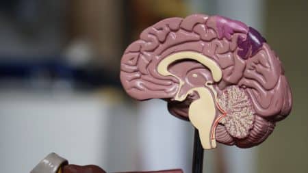Cerveau Parkinson