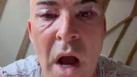 Star Louie Spence Operation