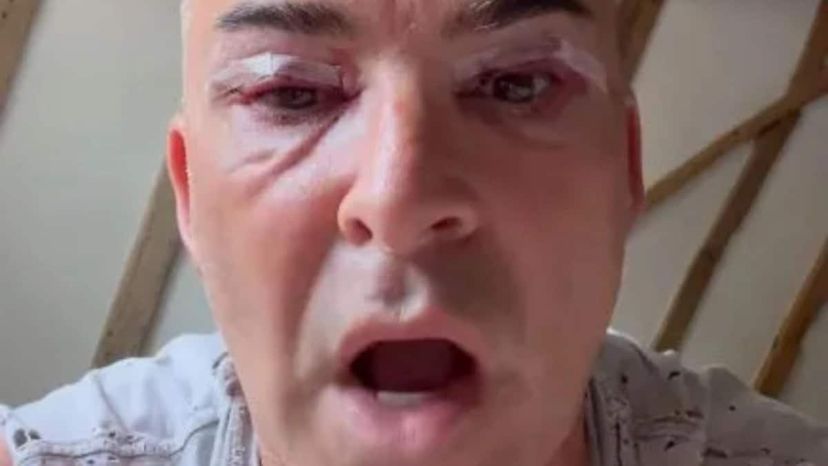 Star Louie Spence Operation