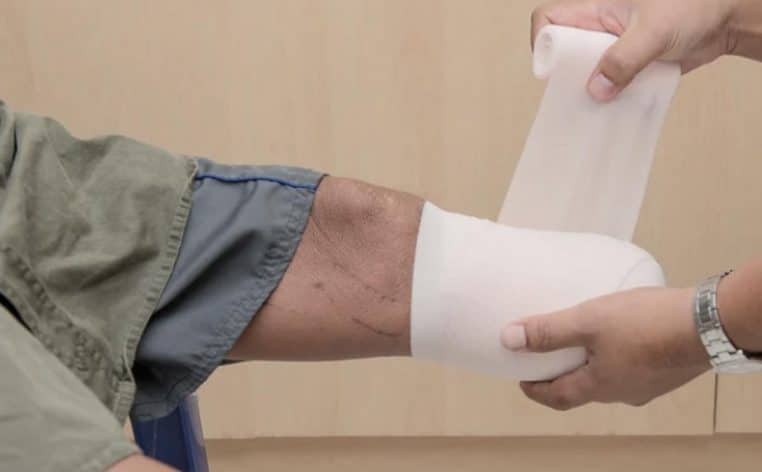 amputation chirurgien