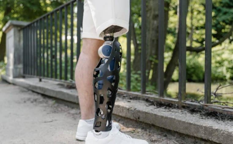 amputation chirurgien