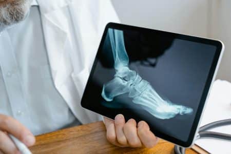 Il découvre des asticots sur ses pieds !