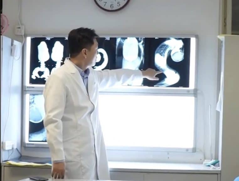 Médecin garçon courbé