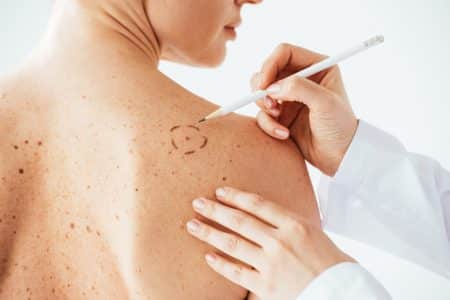 melanome diagnostic pire jamais vu