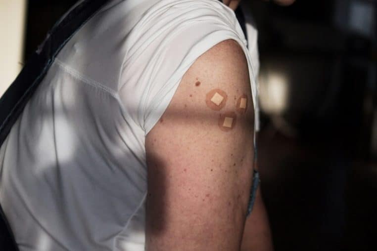 bras avec band aid piqûres