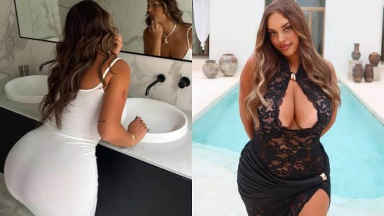 Alanna influenceuse chirurgie esthétique BBL