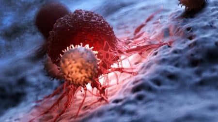Cancer Symptomes Silencieux