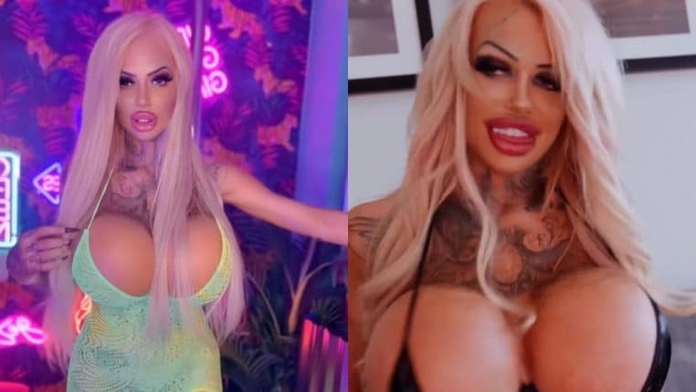 Chirurgie esthétique pour ressembler à une poupée Bratz