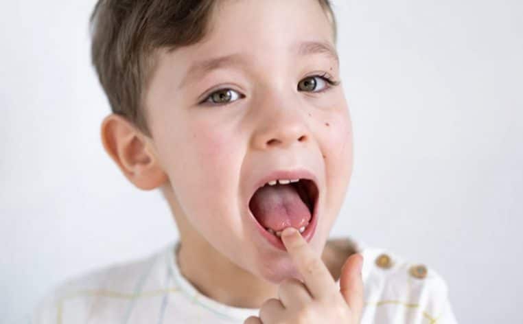 enfant dent qui bouge actu