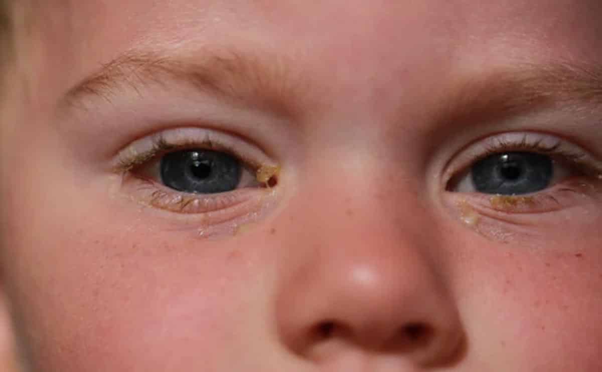 œil enfant petite fille santé