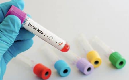 virus alerte maladie actualité