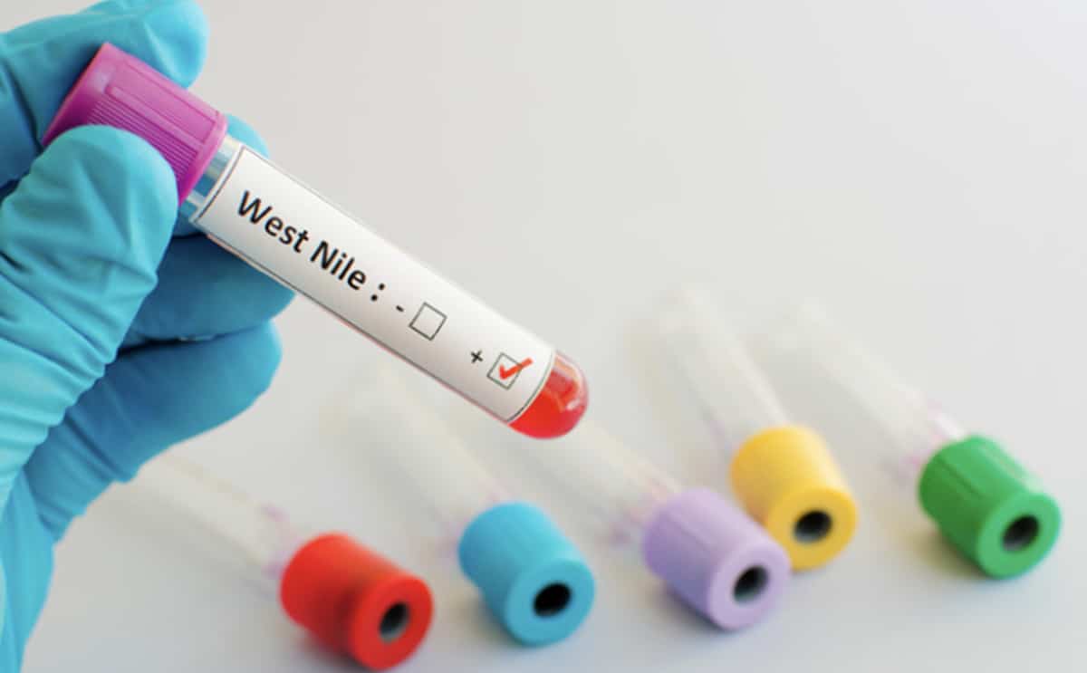 virus alerte maladie actualité