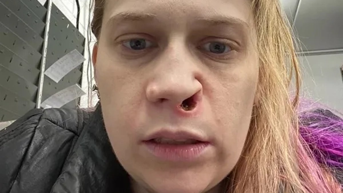 Femme Addiction Cocaine