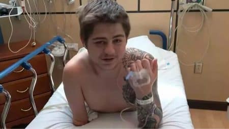 Homme Accident Amputation