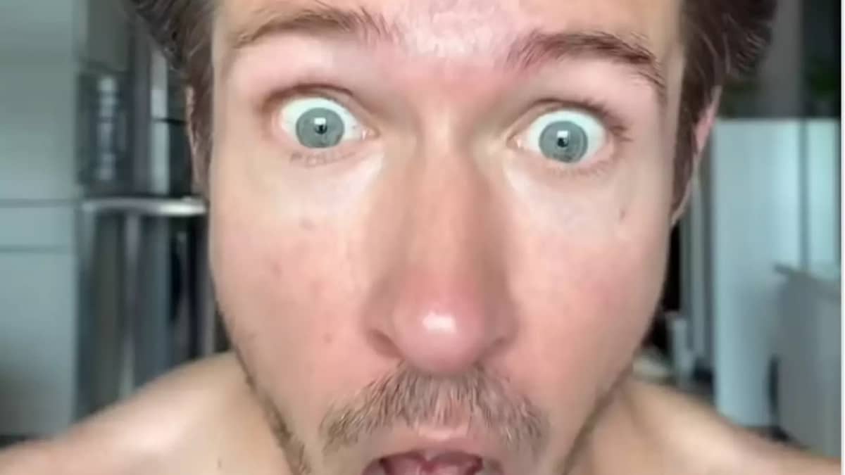 Homme Cheveux Resultats Stupeur