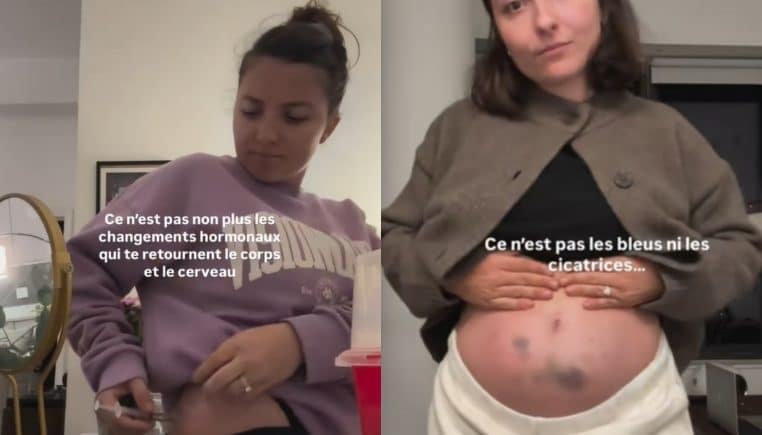 TikTokeuse infertile dévoile son quotidien