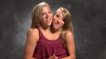 Jumelles Abby Brittany Hensel