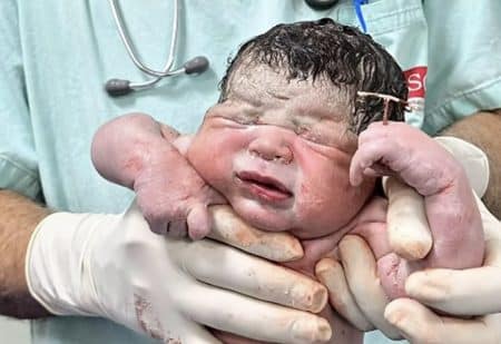 bebe sterilet