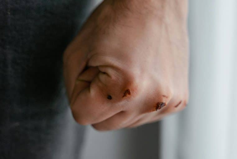 Il passe sa sœur à tabac