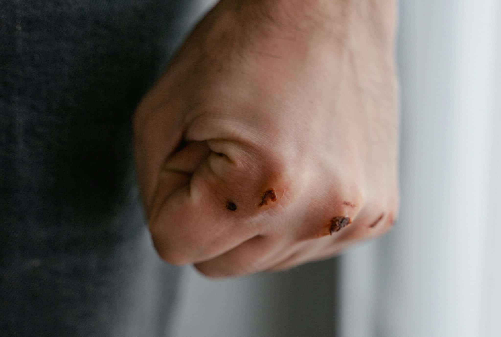 Il passe sa sœur à tabac