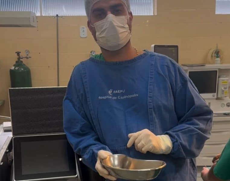 Il retrouve 35 calculs dans le corps d'un patient